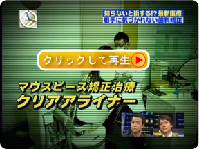 見えない矯正 クリアアライナー動画